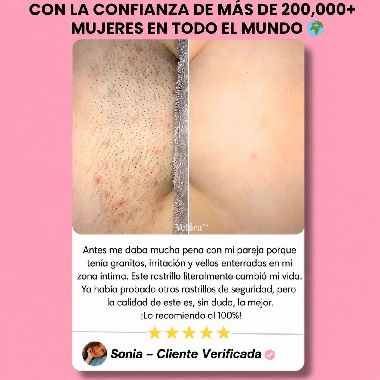 Rasuradora Velora™ — Piel suave sin irritación, para siempre