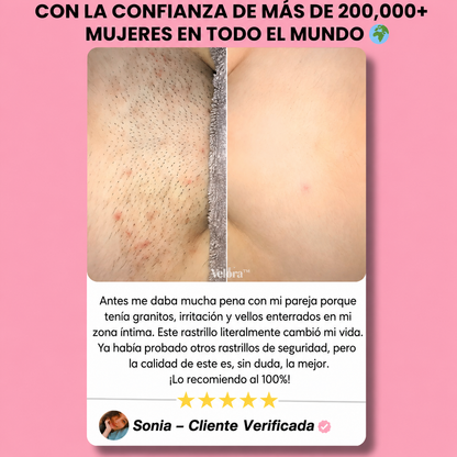 Rasuradora Velora™ — Piel suave sin irritación, para siempre