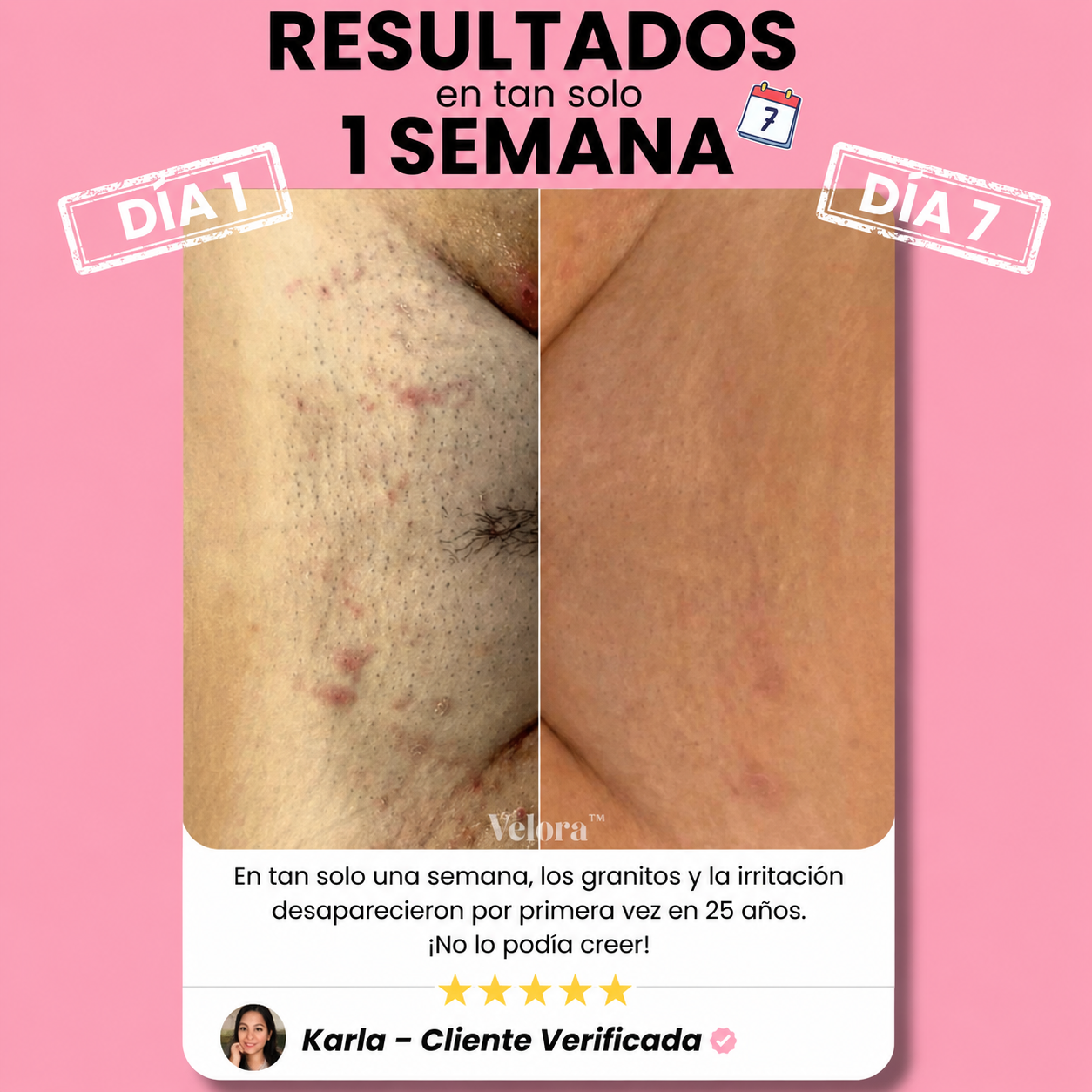 Rasuradora Velora™ — Piel suave sin irritación, para siempre