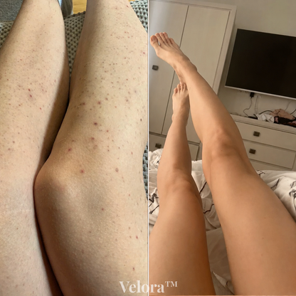 Rasuradora Velora™ — Piel suave sin irritación, para siempre