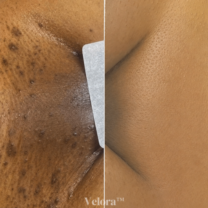 Rasuradora Velora™ — Piel suave sin irritación, para siempre